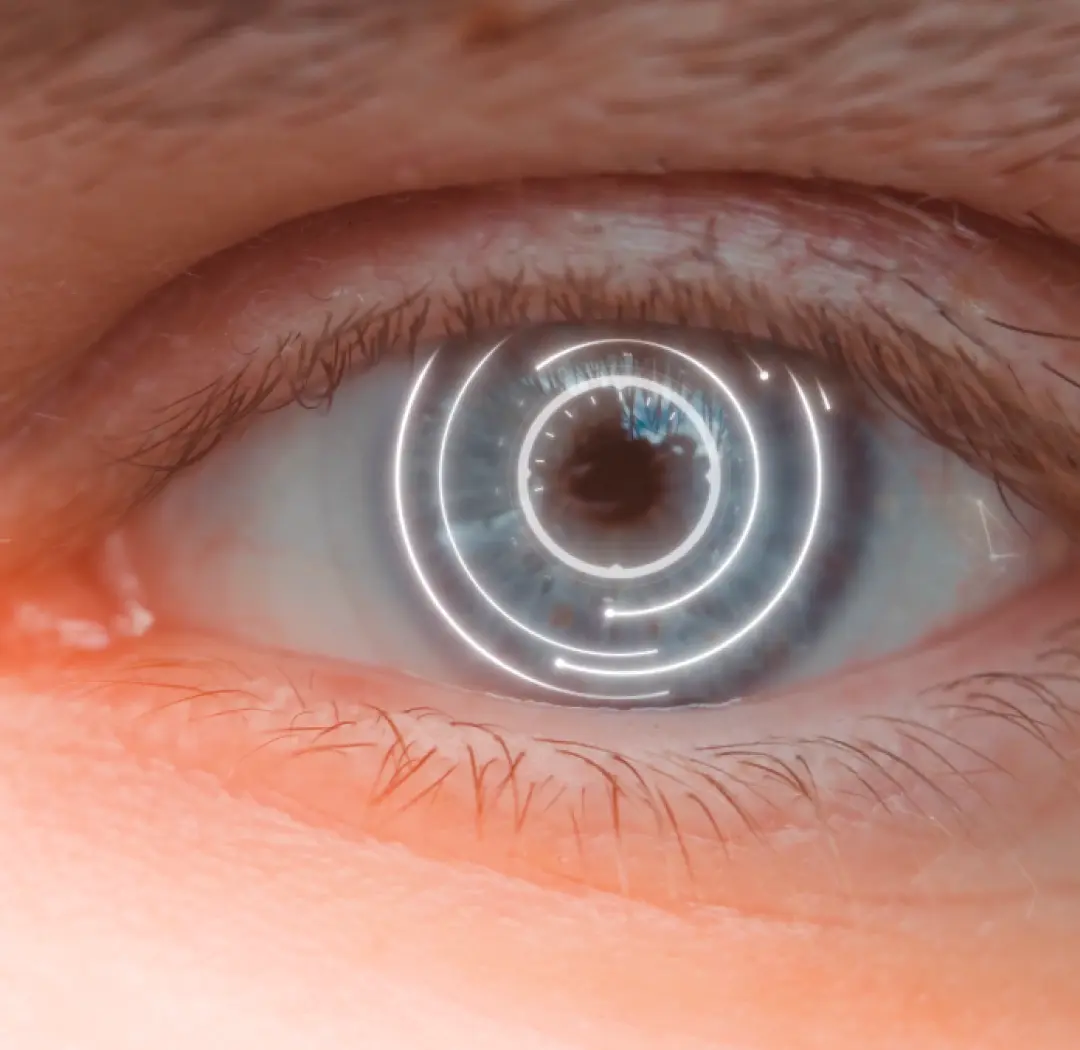eye